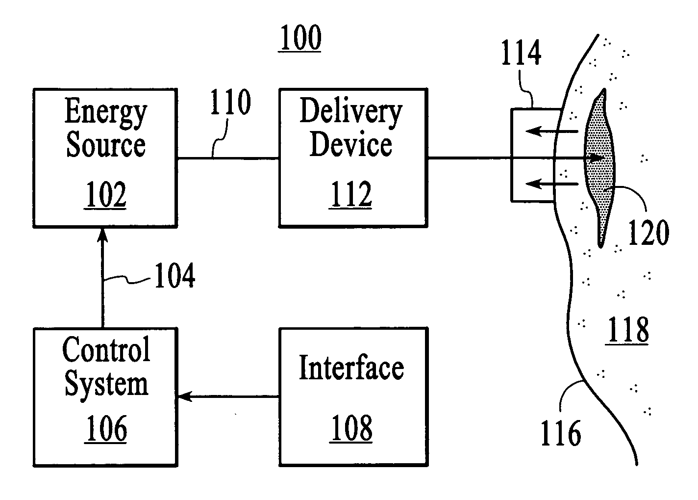 Treatment of cellulite with mid-infrared radiation