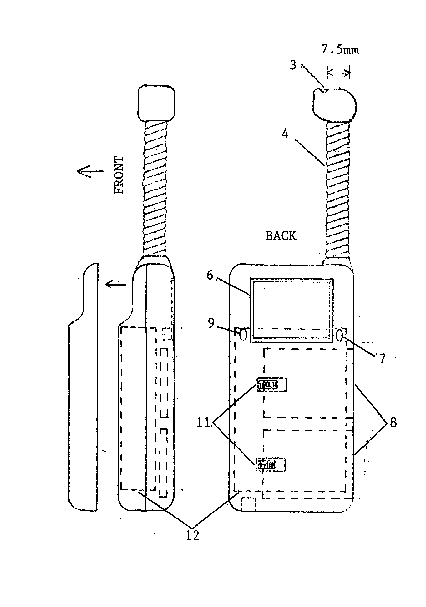 Mobile digital surveillance system