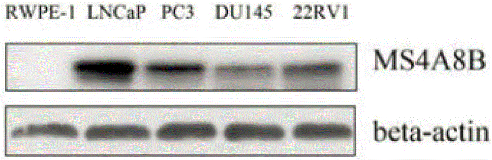 Method for studying on prostate cancer reoccurrence and metastasis