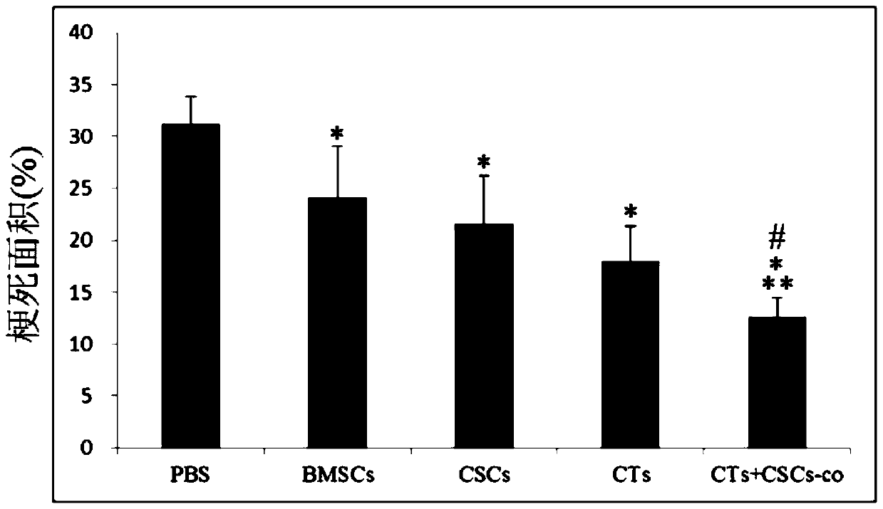 A kind of mixed cell preparation for treating myocardial infarction and its preparation method and application