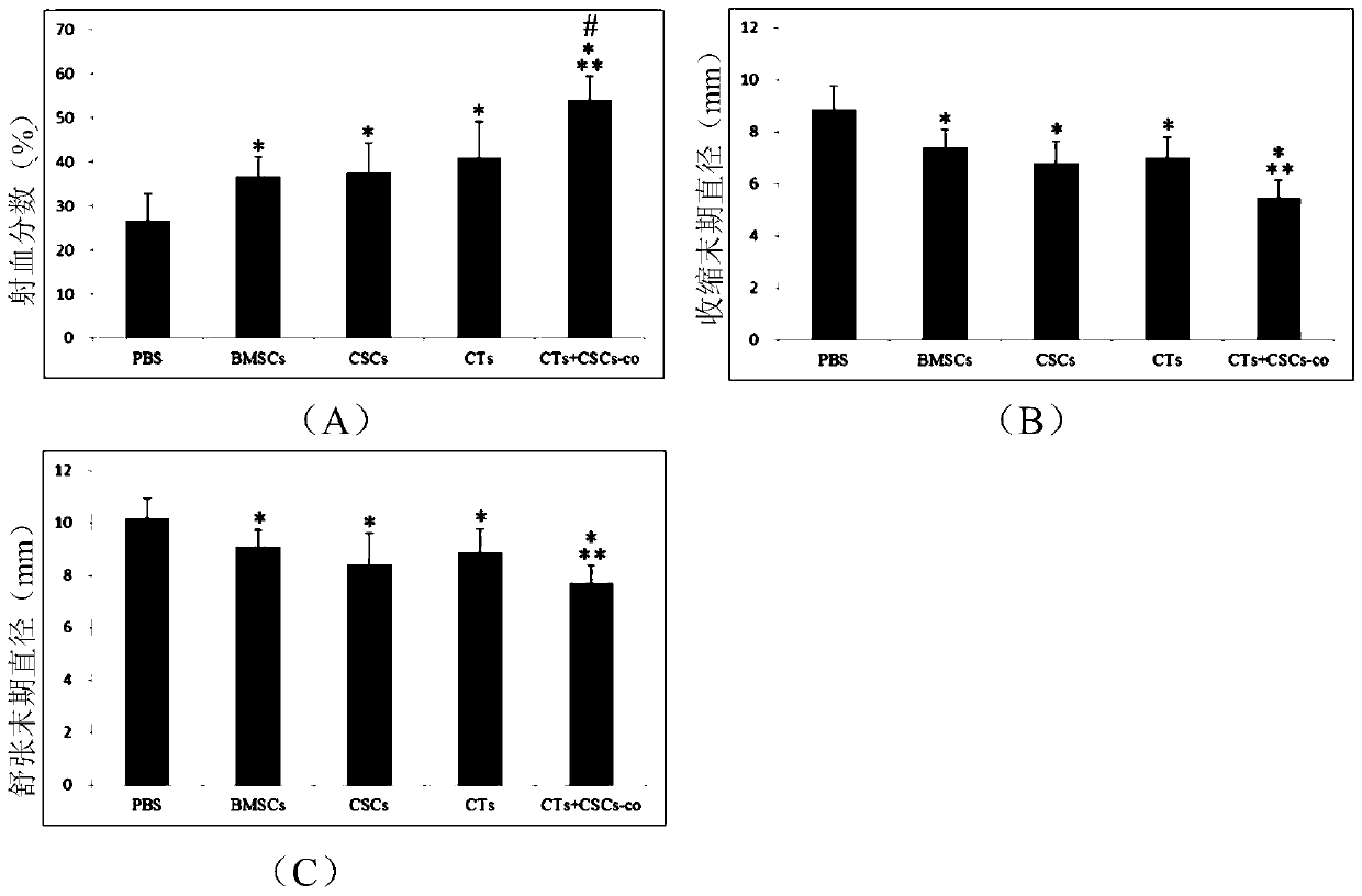 A kind of mixed cell preparation for treating myocardial infarction and its preparation method and application