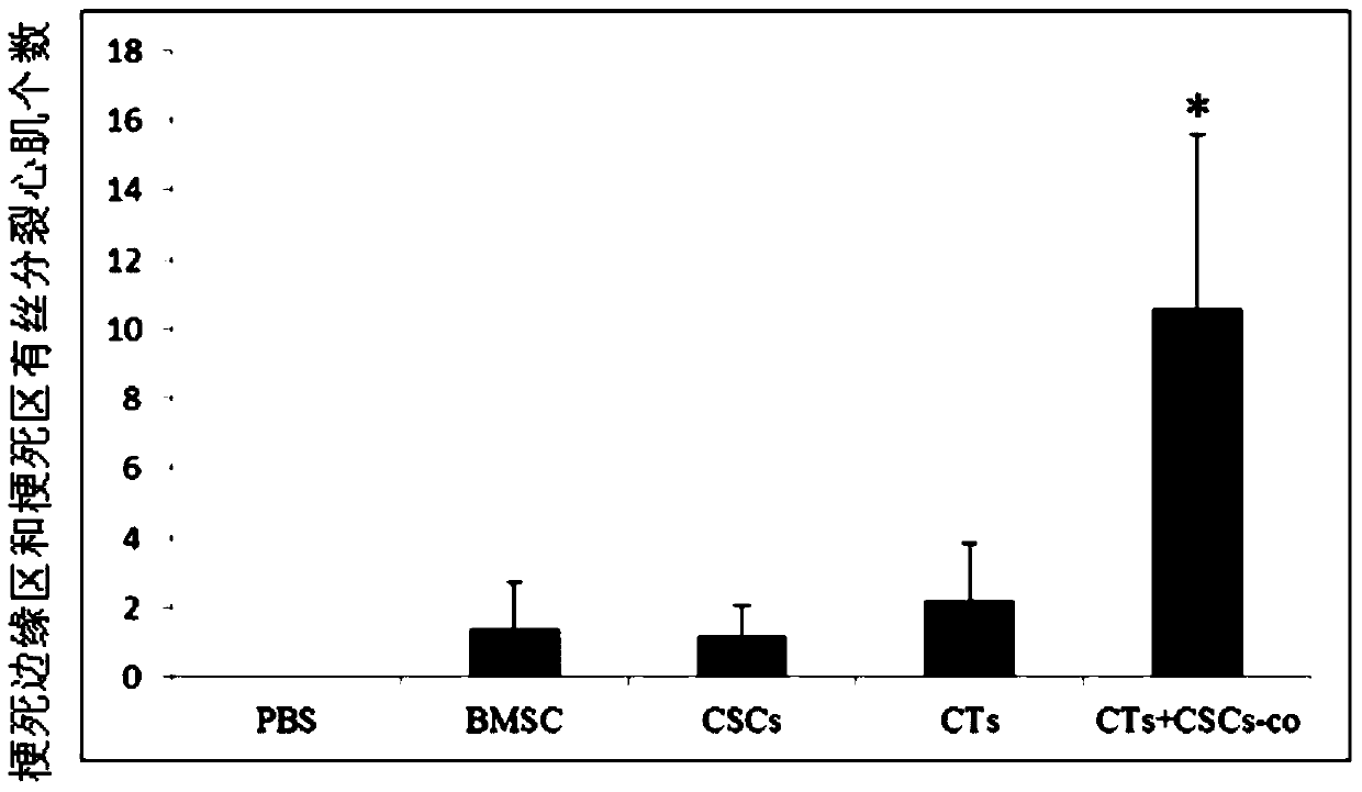 A kind of mixed cell preparation for treating myocardial infarction and its preparation method and application