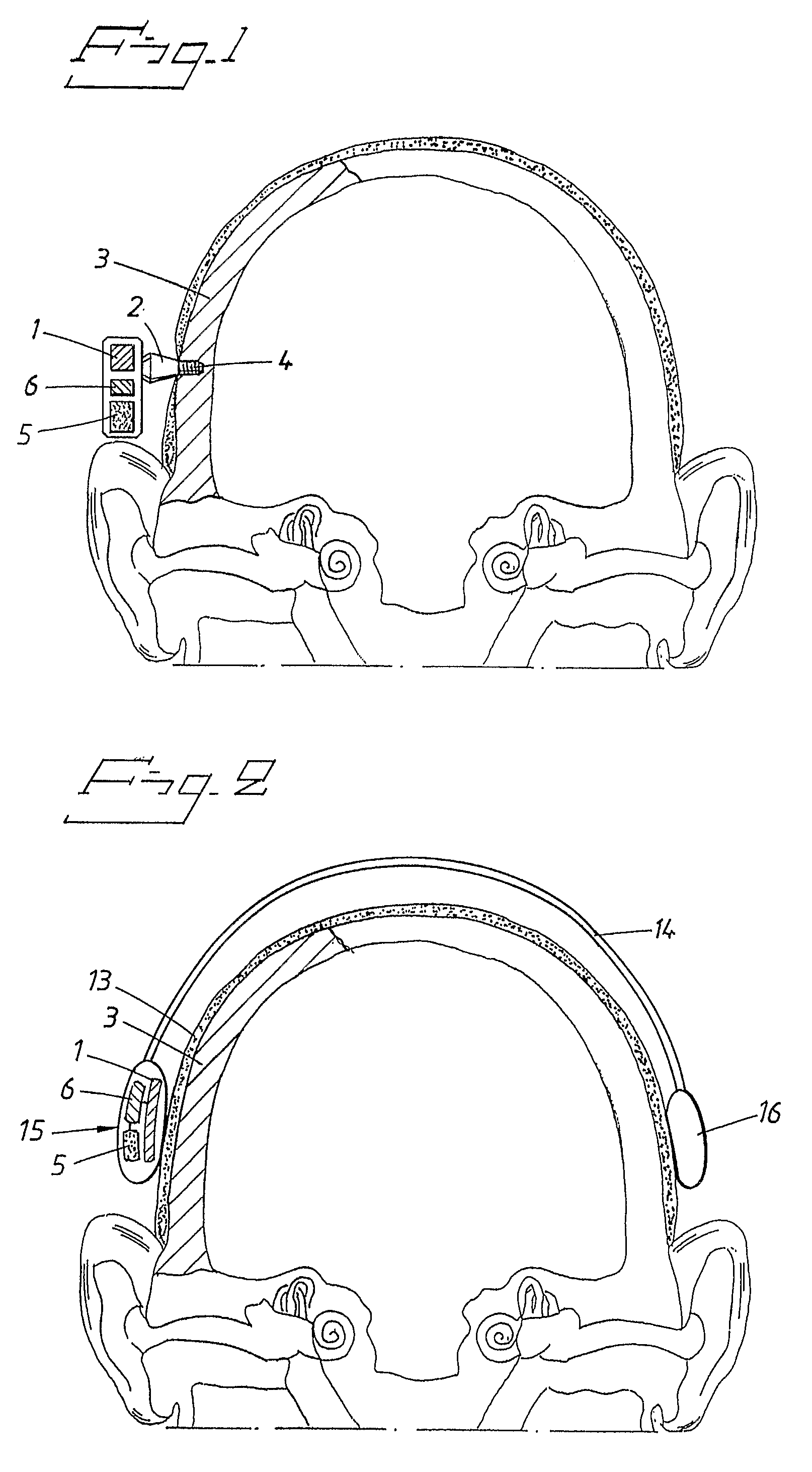 Anti-stuttering device