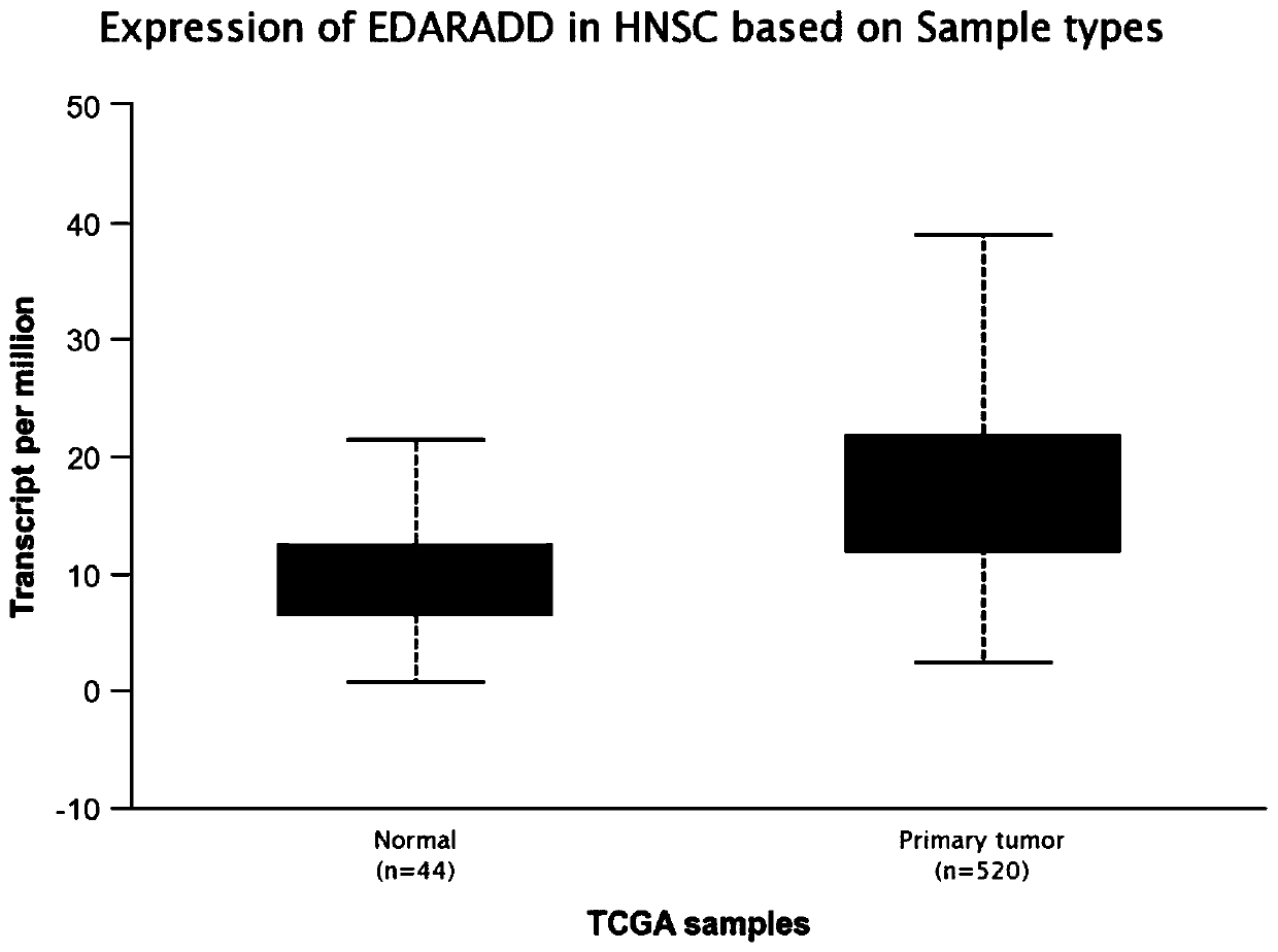 ShRNA for inhibiting human EDARADD gene expression, lentiviral vector and construction method and application of lentiviral vector