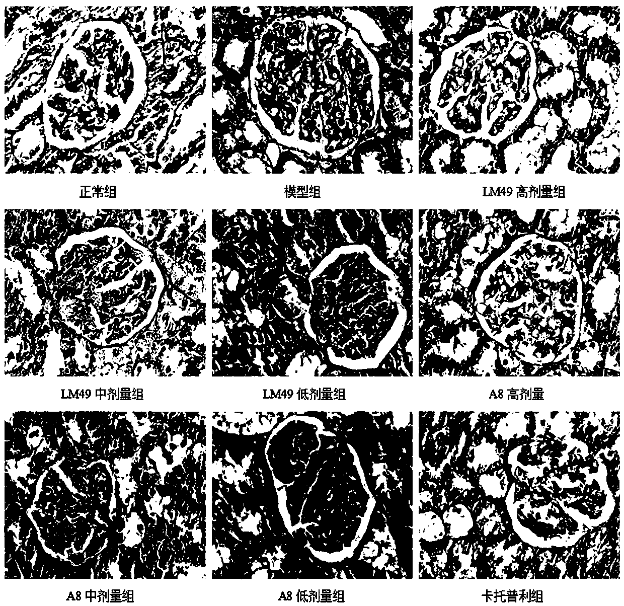 Application of Two Halophenol Compounds in the Preparation of Drugs Against Type Ⅱ Diabetic Nephropathy