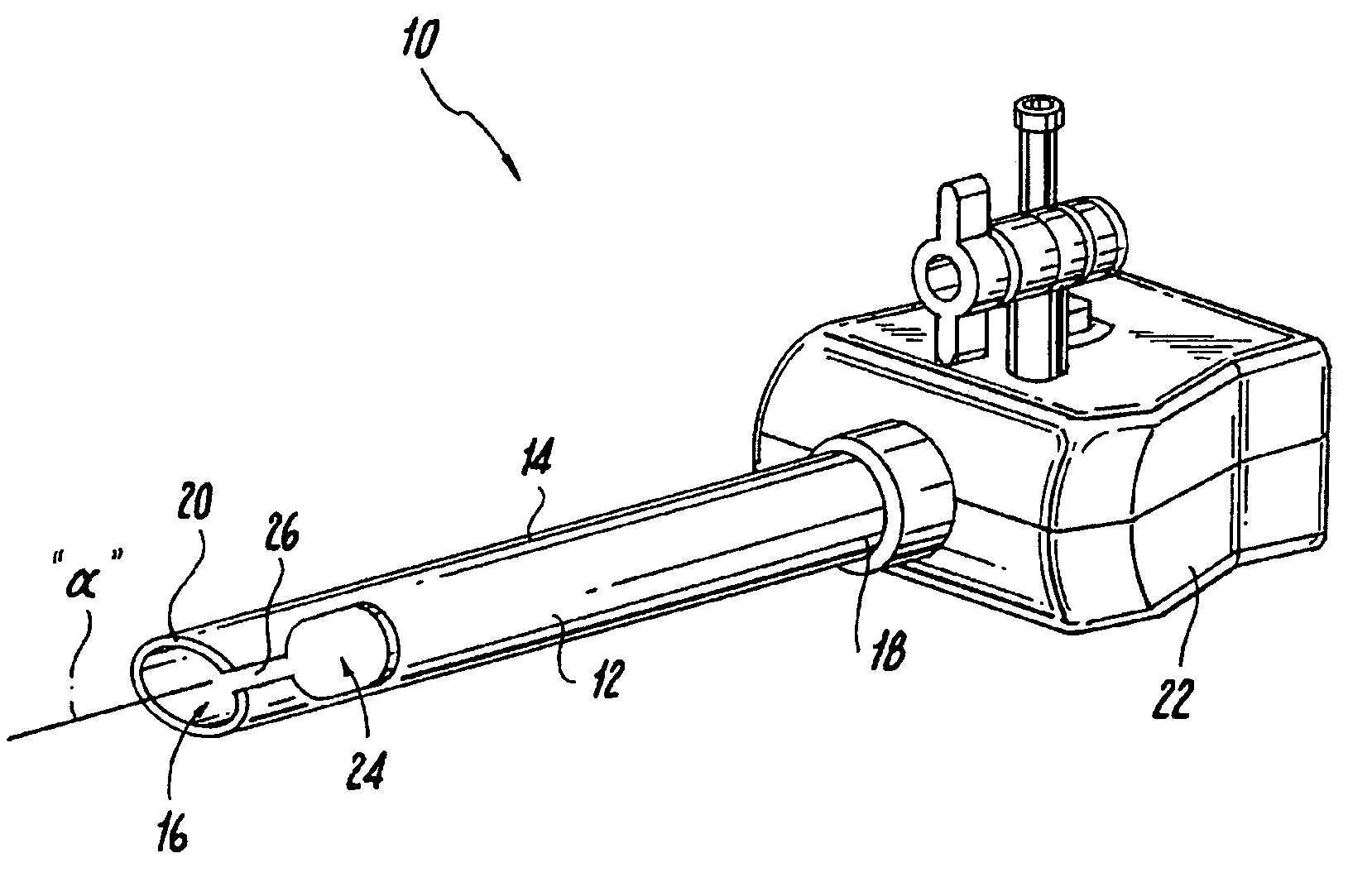 Endoluminal colostomy system and procedure