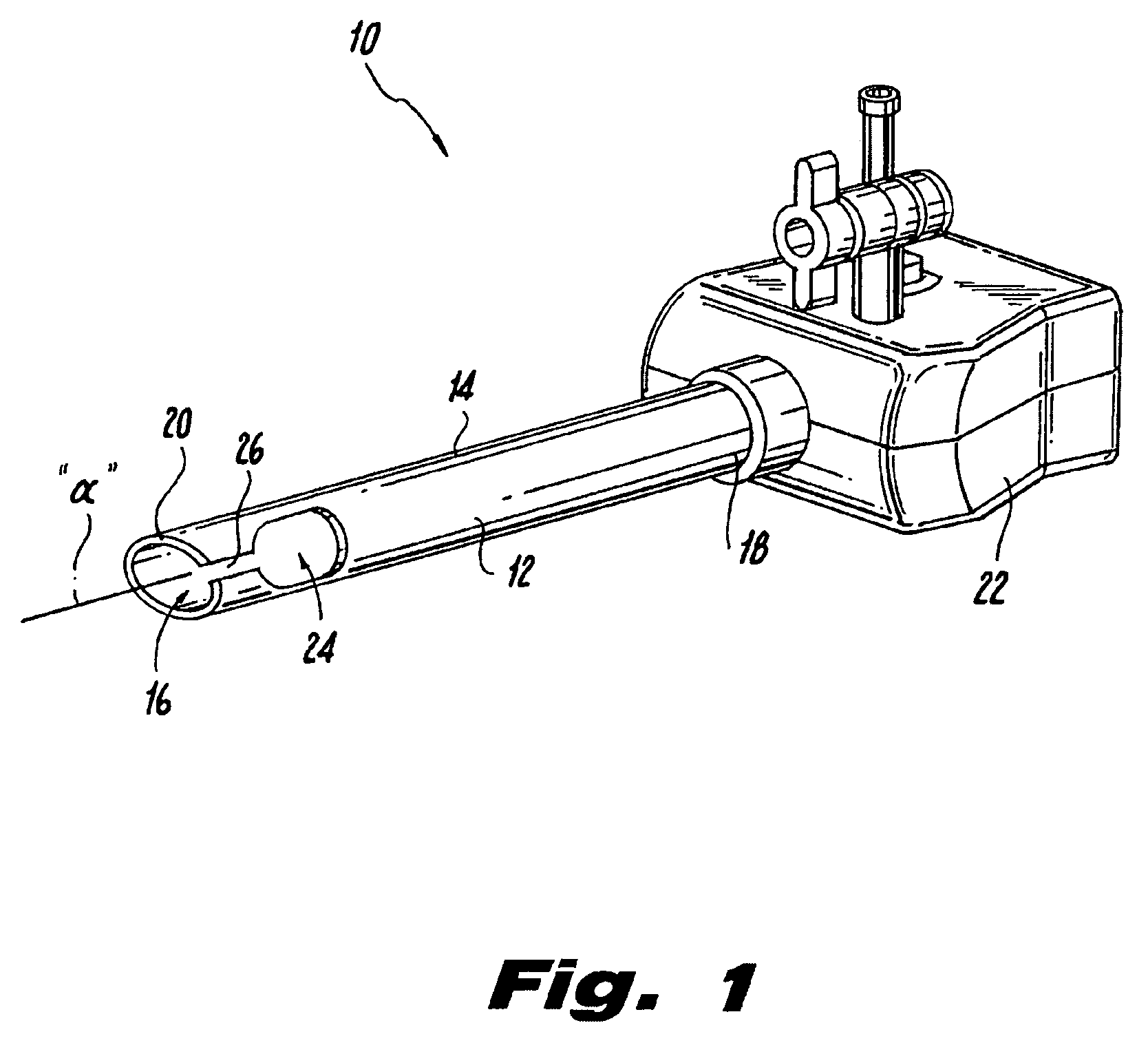 Endoluminal colostomy system and procedure