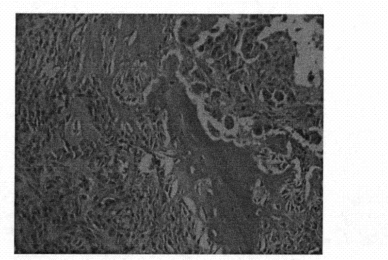 Parental human lung adenocarcinoma cell line with high potential of bone metastasis