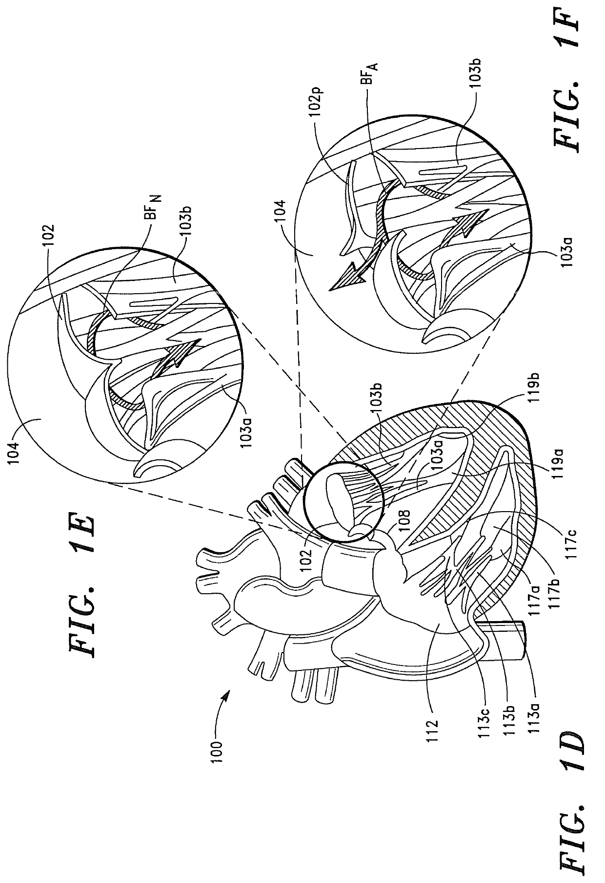 Prosthetic Cardiovascular Valves and Methods for Replacing Native Atrioventricular Valves with Same