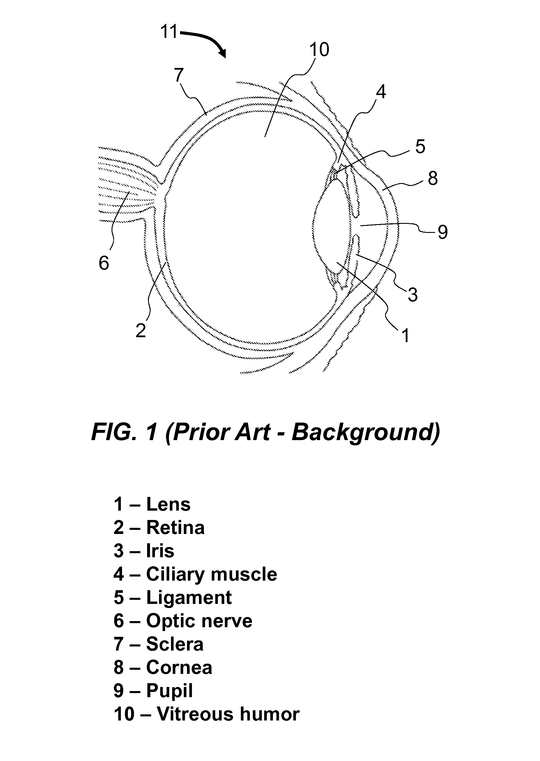 Method and apparatus to produce re-focusable vision with detecting re-focusing event from human eye