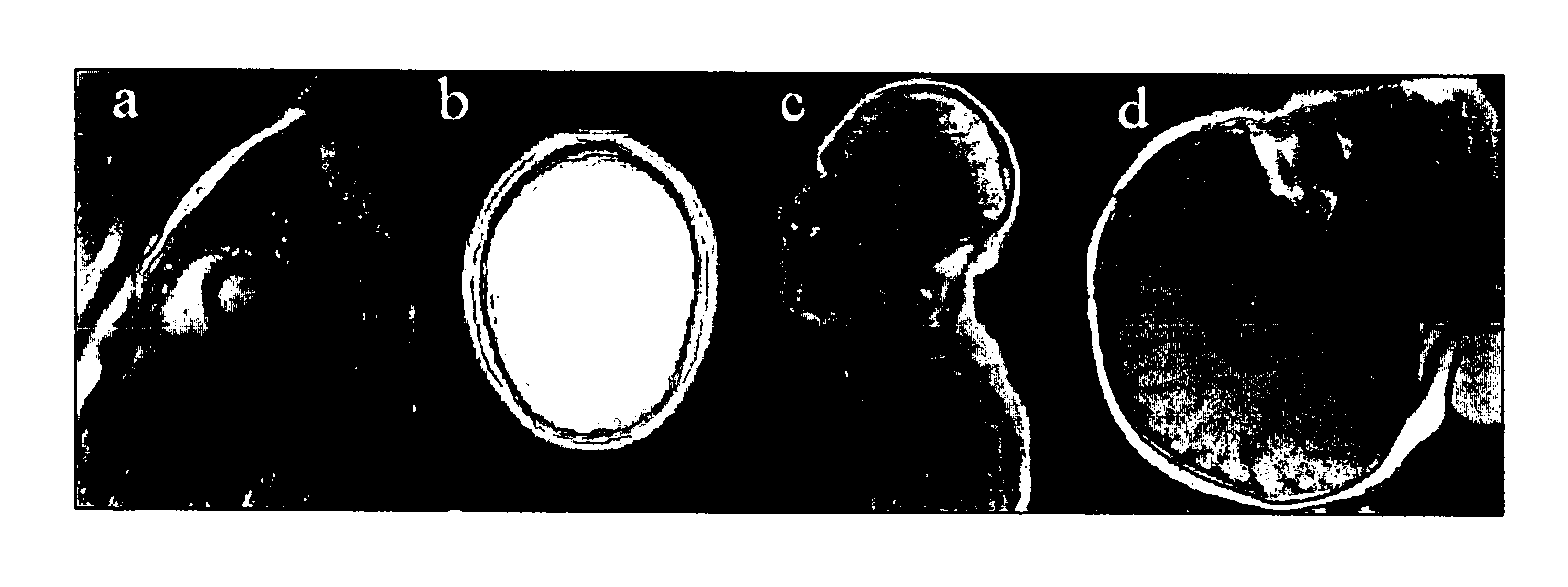 Method for image intensity correction using extrapolation and adaptive smoothing