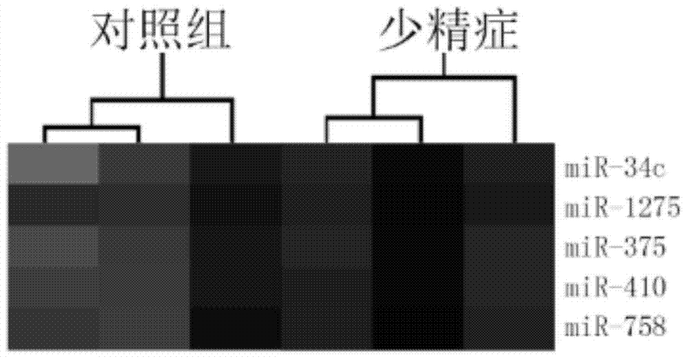 A kind of serum miRNA biomarker composition and application