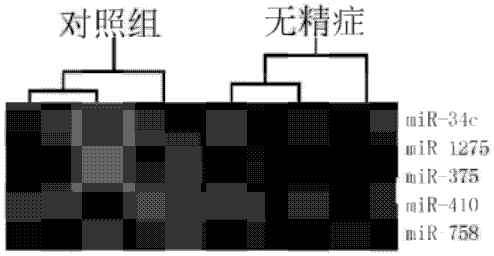 A kind of serum miRNA biomarker composition and application