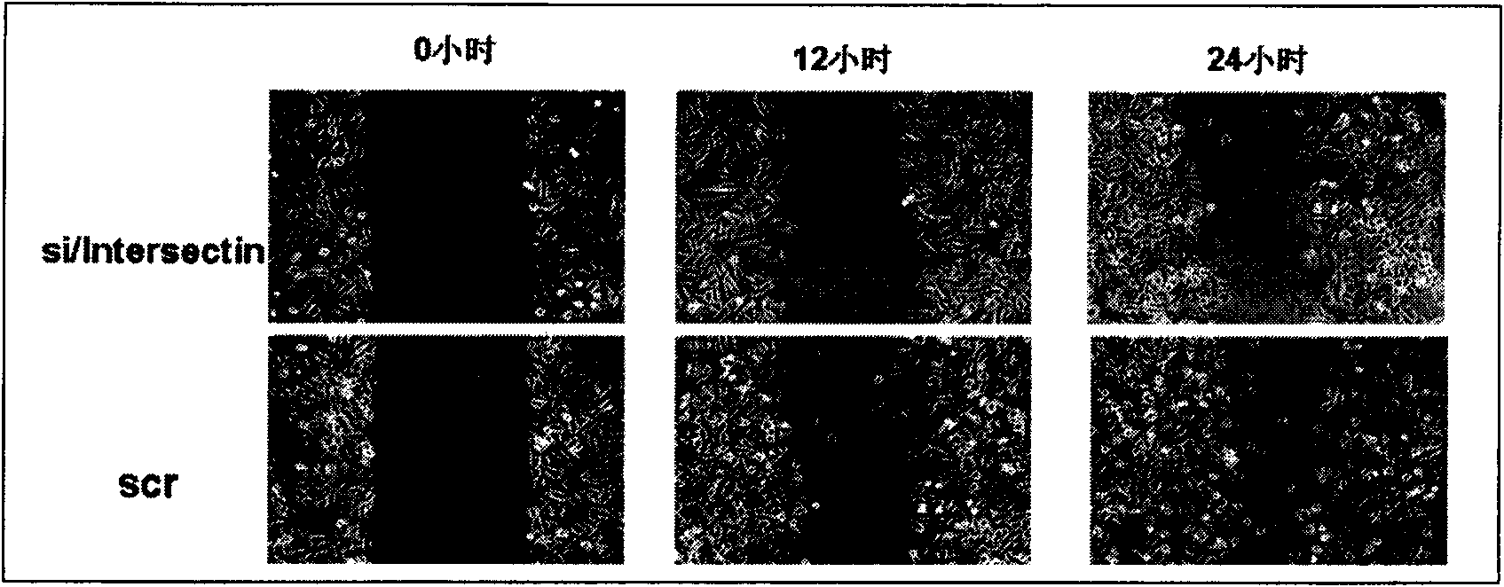 Bridge molecule 1-siRNA interference sequence and fusion expression vector thereof