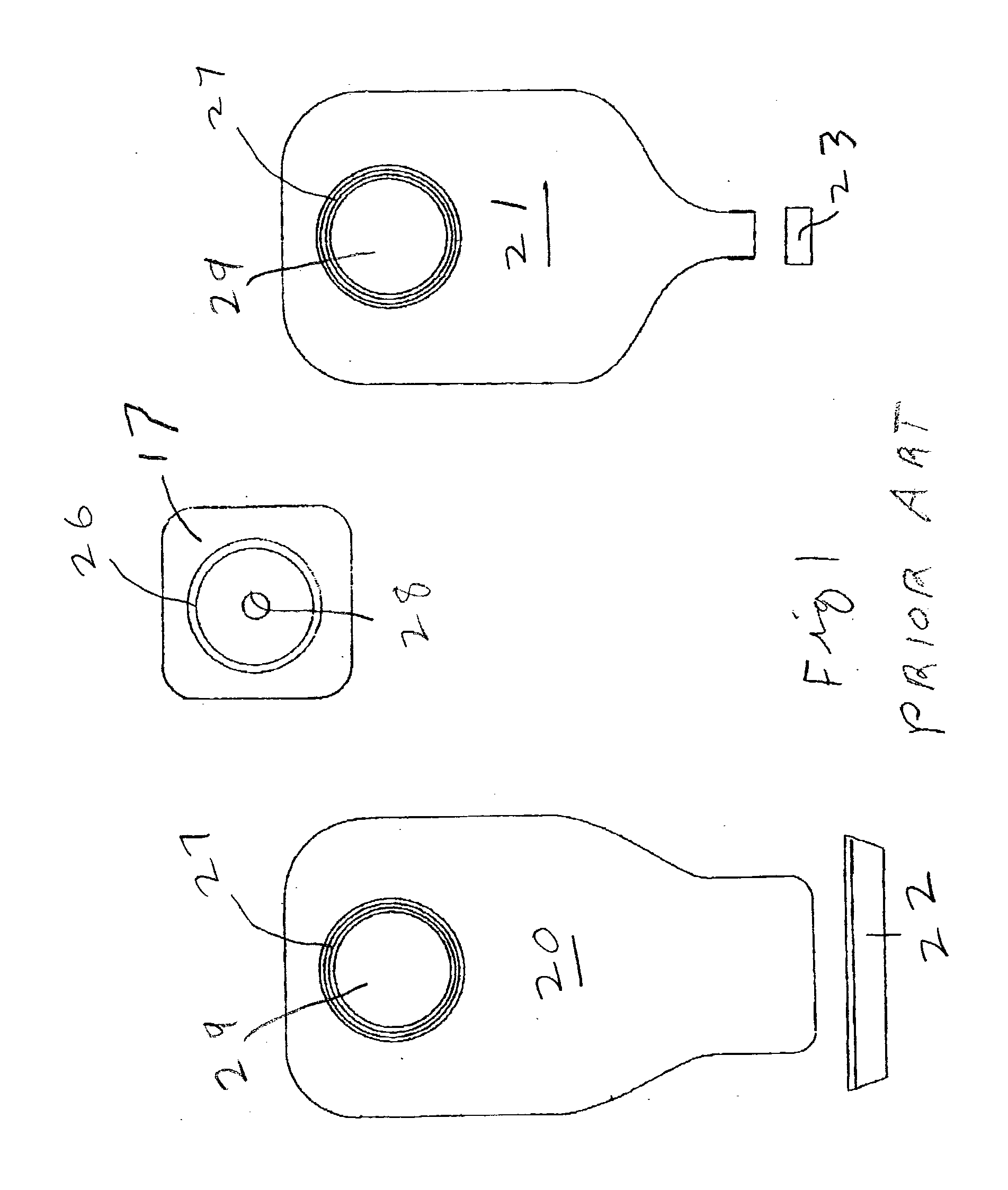 Display arrangement for ostomy care