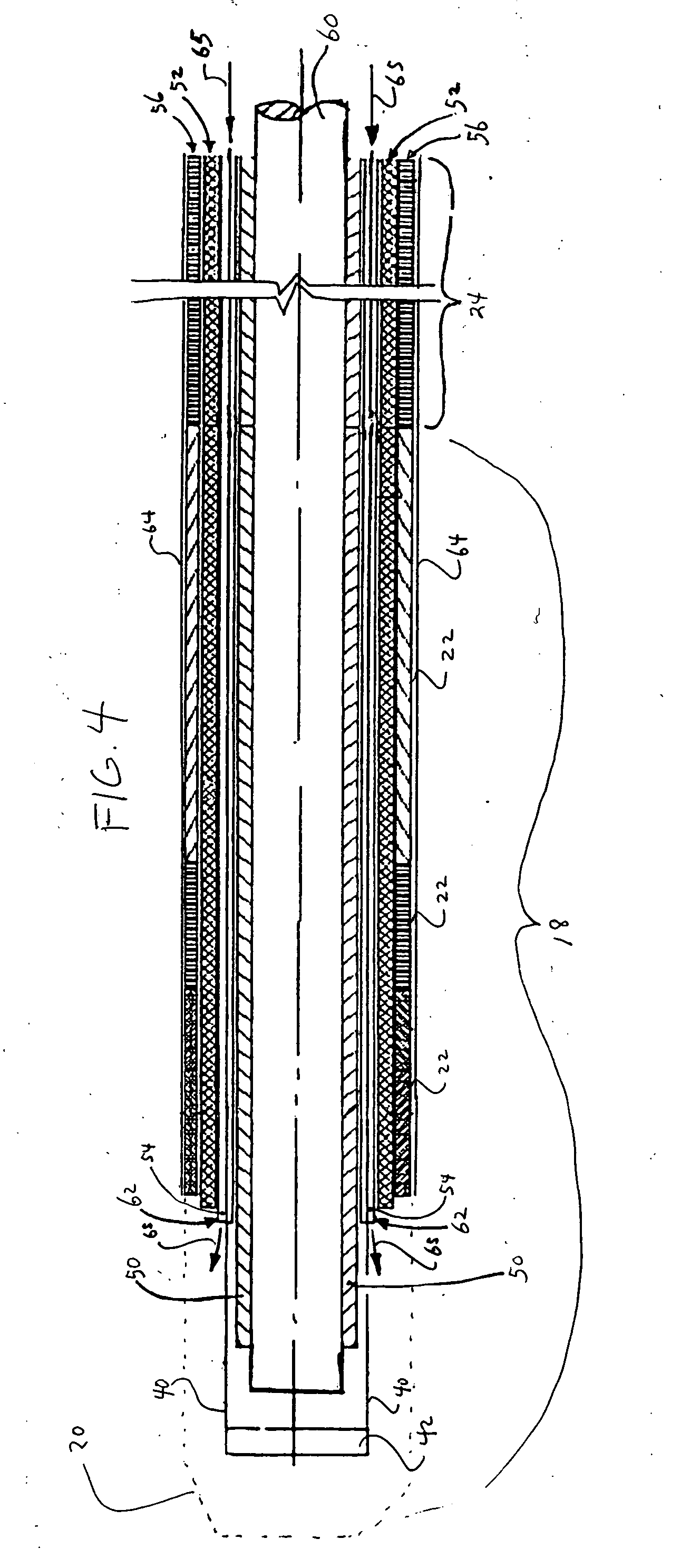 Steerable catheter and methods of making the same