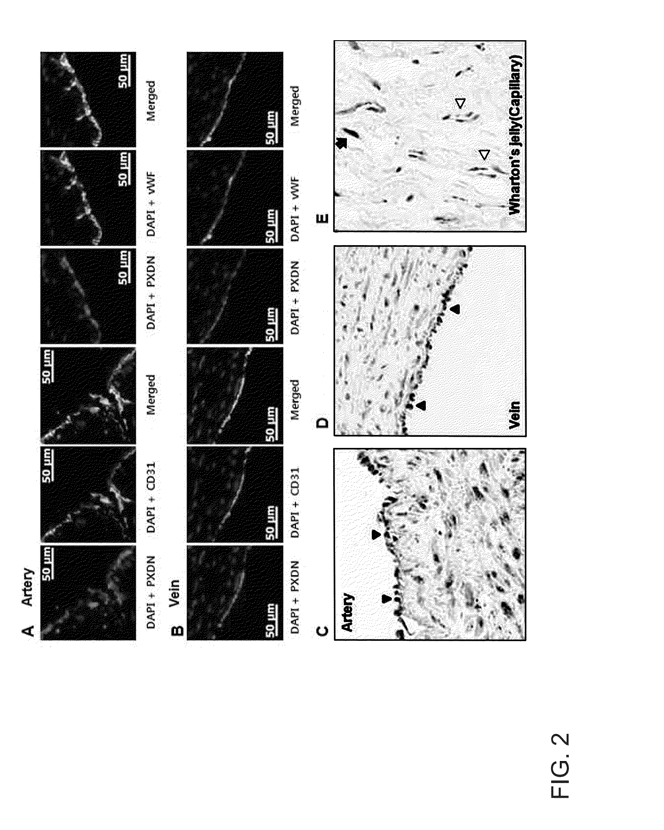 Composition for inhibiting angiogenesis containing a peroxidasin inhibitor as an active ingredient