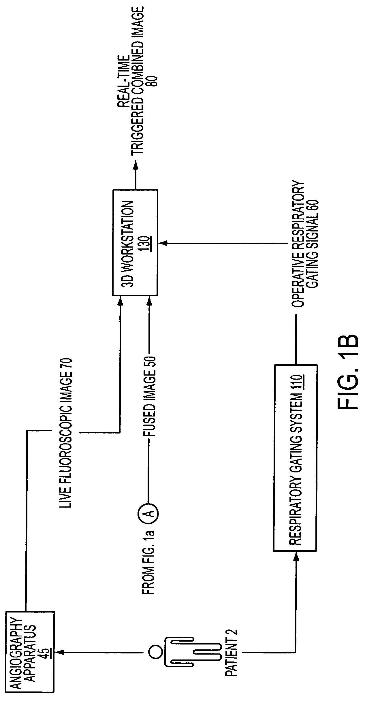 Respiratory gated image fusion of computed tomography 3D images and live fluoroscopy images