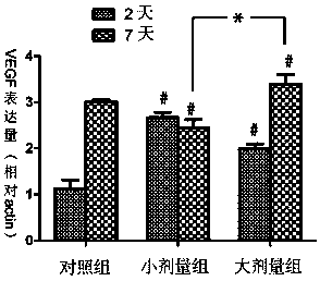 Combined application of statins and corticosteroids in the treatment of chronic subdural hematoma