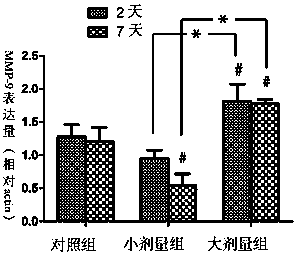 Combined application of statins and corticosteroids in the treatment of chronic subdural hematoma