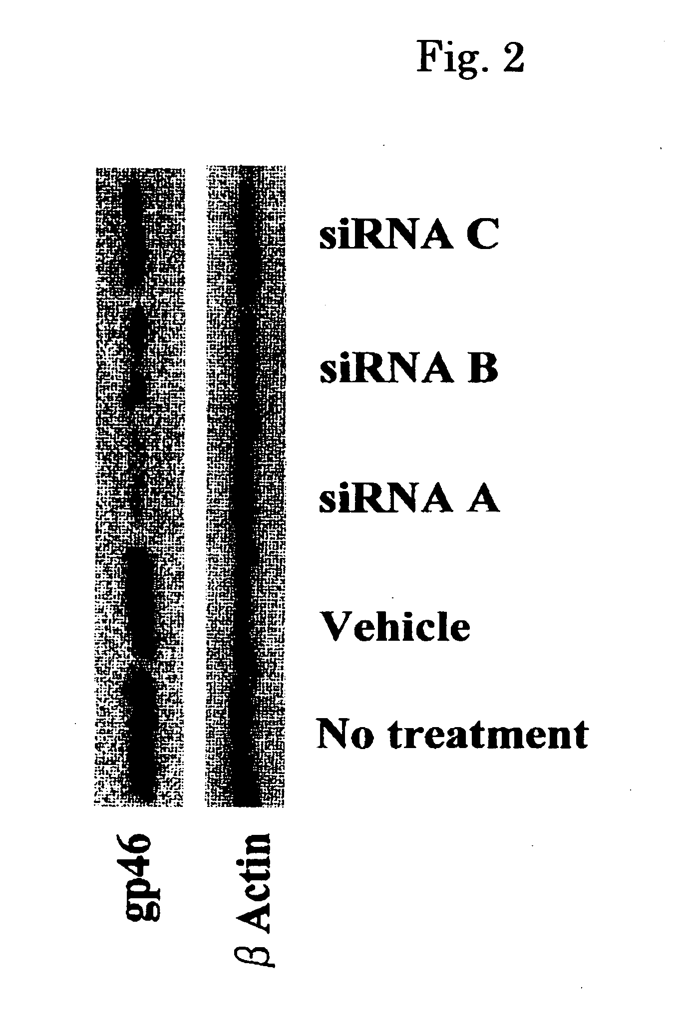 Drug Carrier and Drug Carrier Kit for Inhibiting Fibrosis