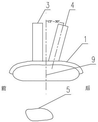 A surgical guide for coracoclavicular ligament reconstruction and its preparation method