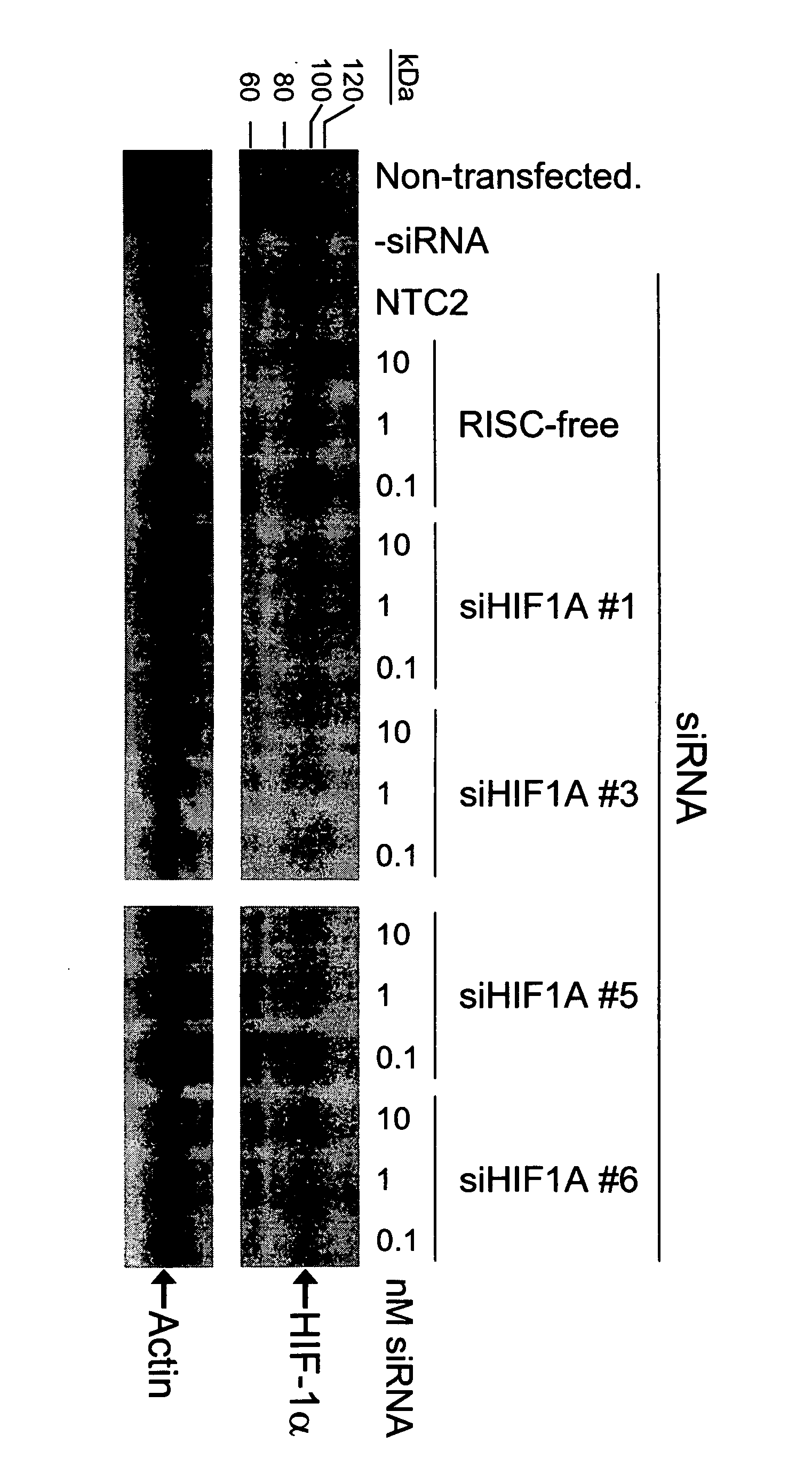 RNAi-mediated inhibition of HIF1A for treatment of ocular angiogenesis