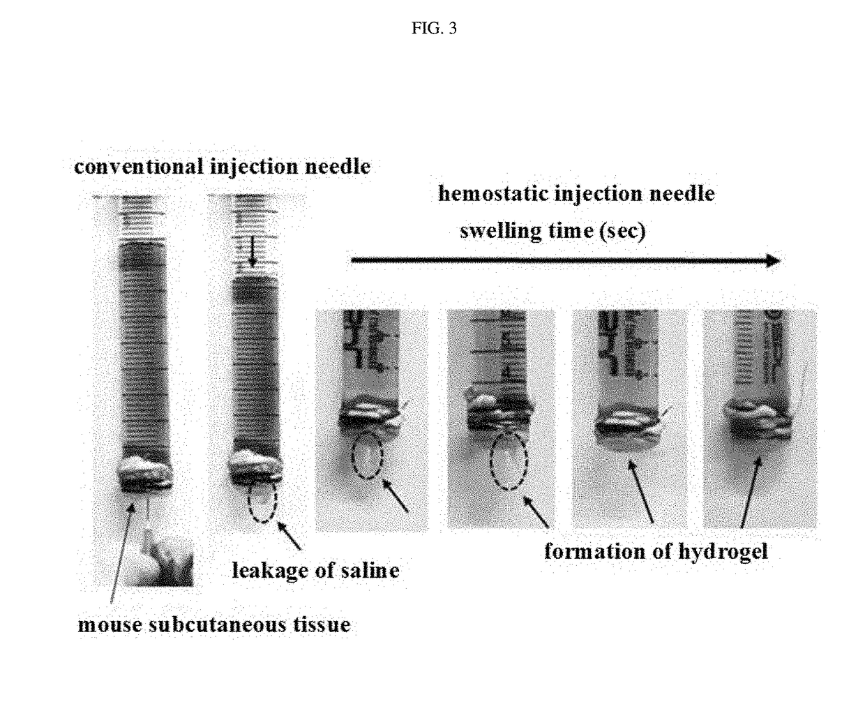 Hemostatic injection needle coated with crosslinked chitosan having catechol group and oxidized catechol group