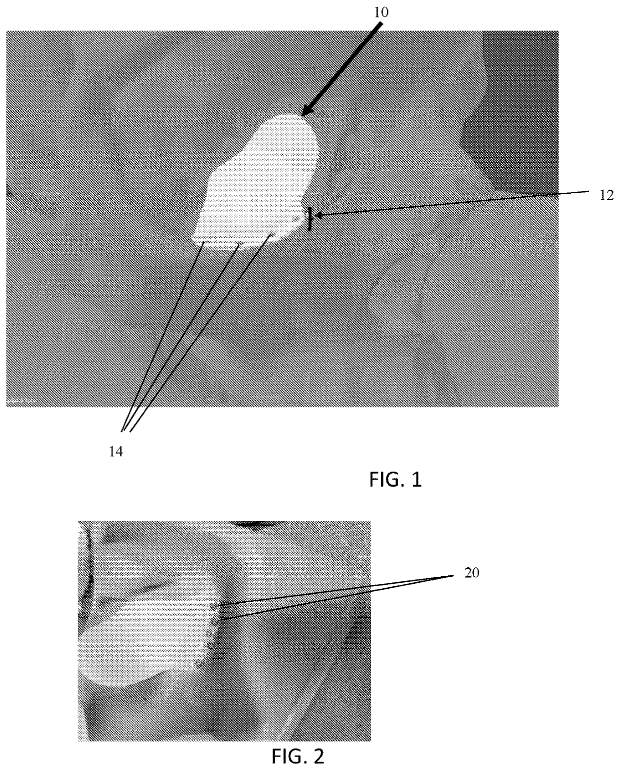 Orbital floor implant