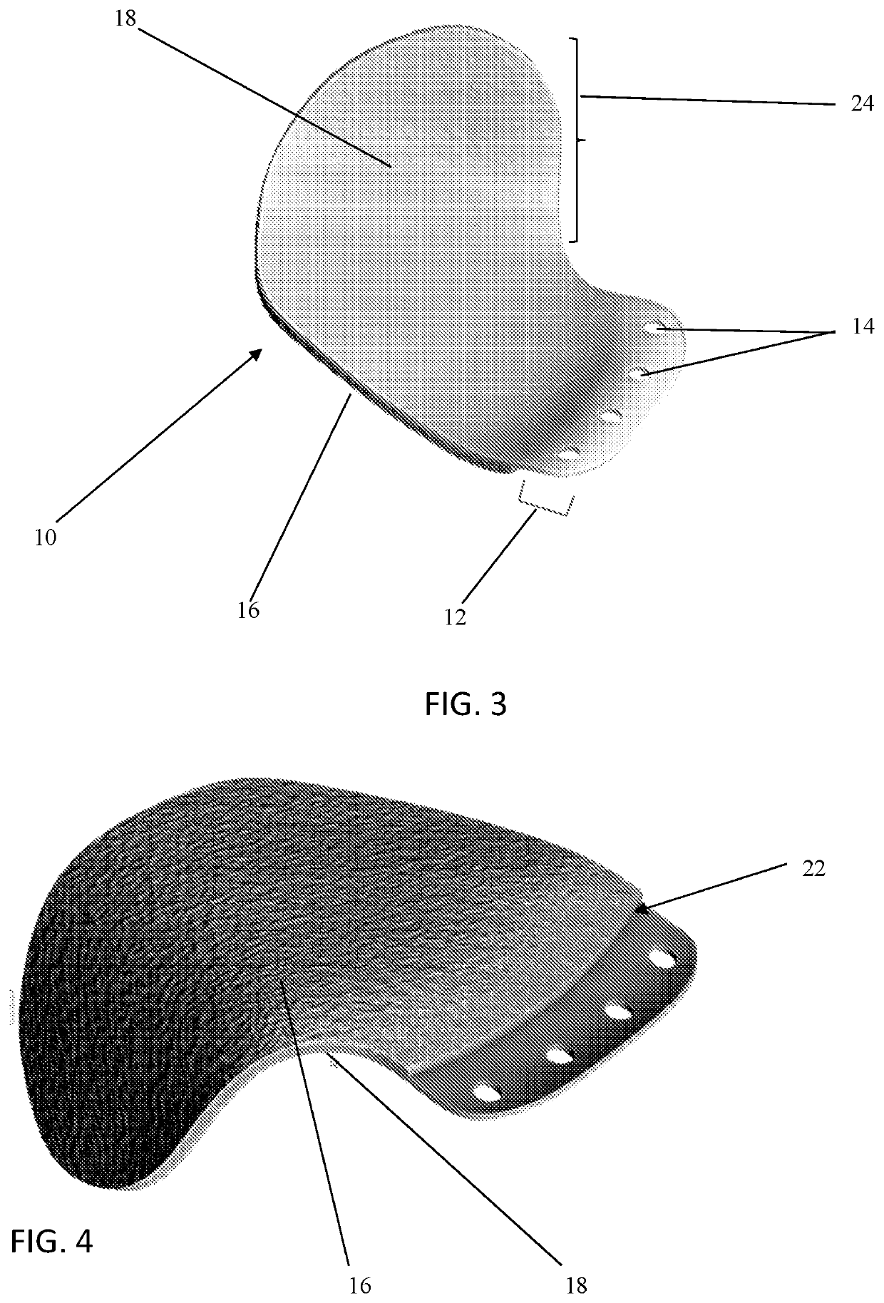 Orbital floor implant