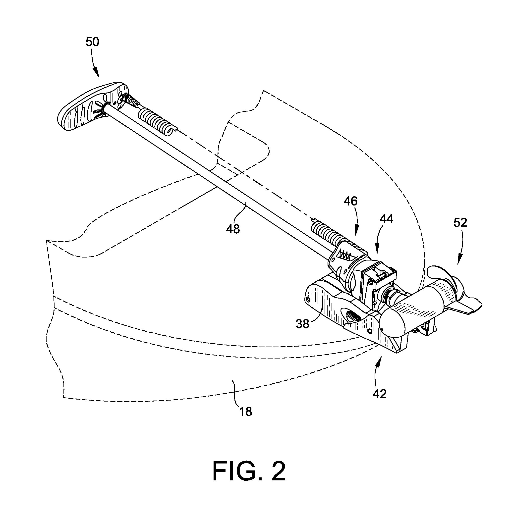 Trolling motor