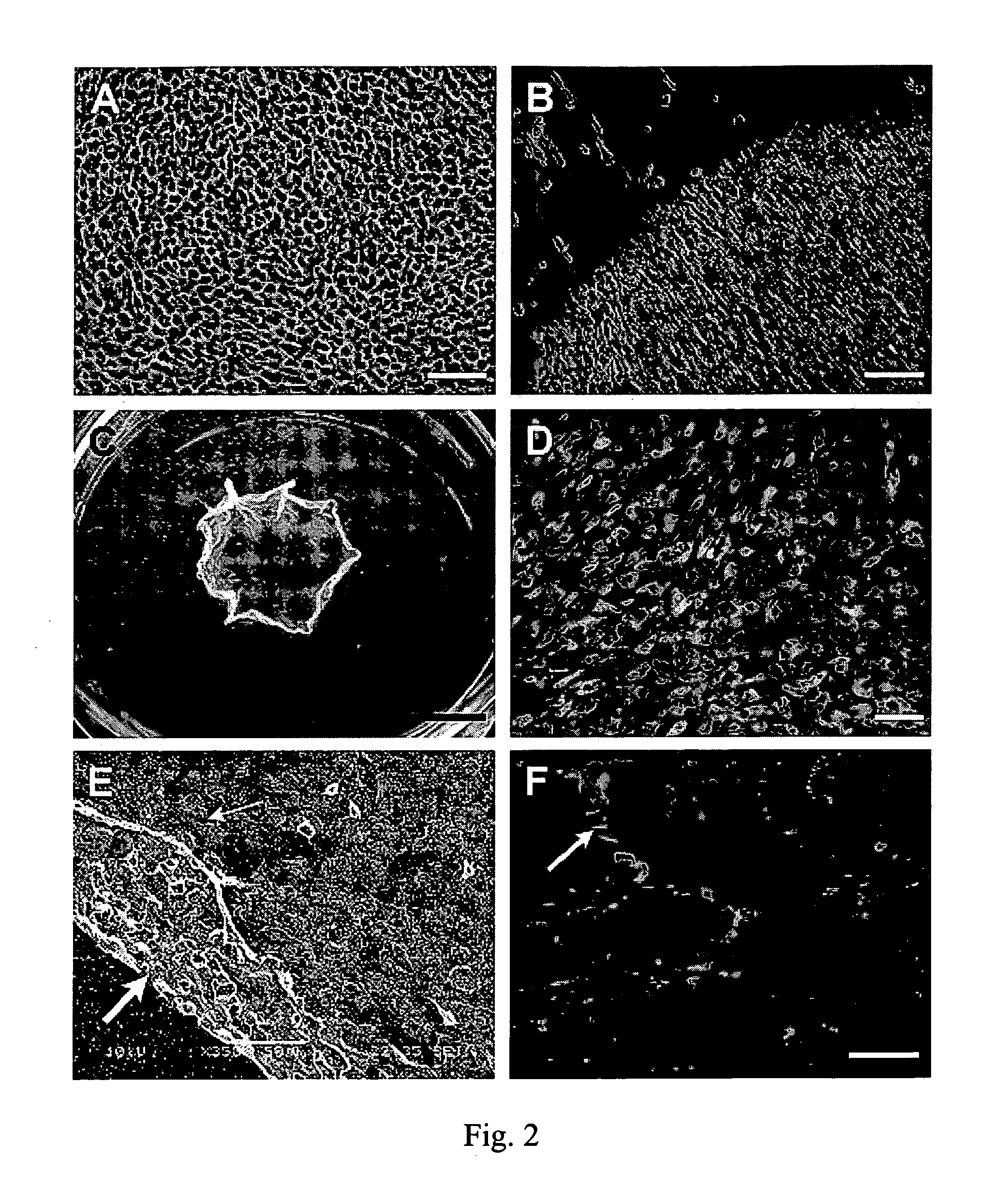 Biopolymer-bioengineered cell sheet construct