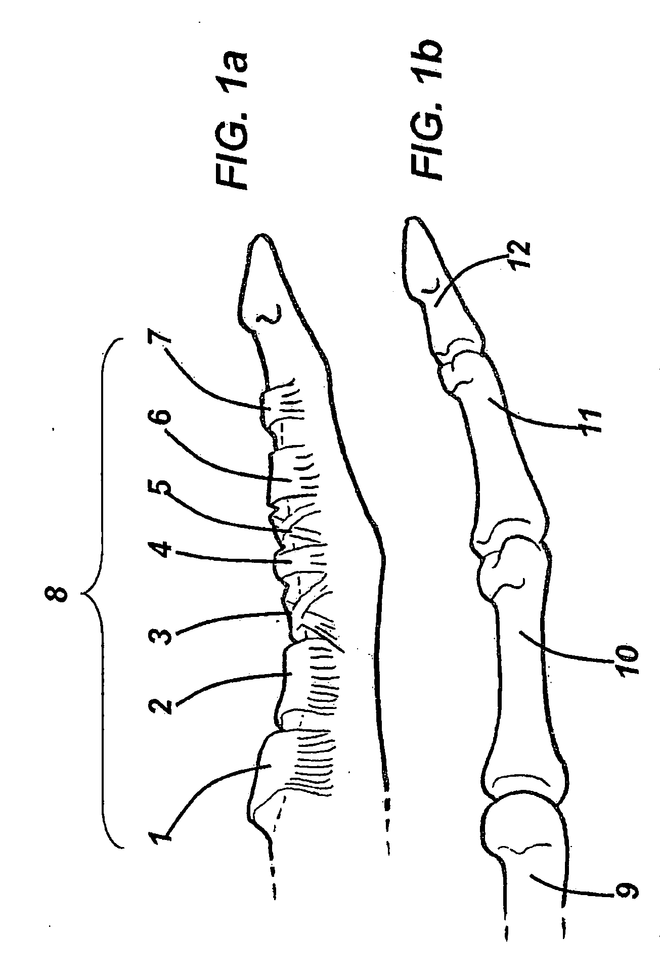 Device and method for assisting in flexor tendon repair and rehabilitation