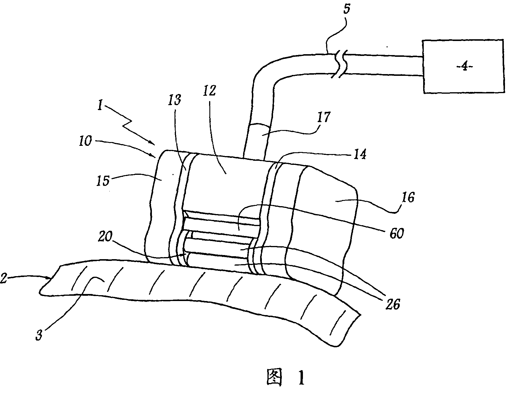 Device for treating, in particular massaging, the connective tissue of the skin