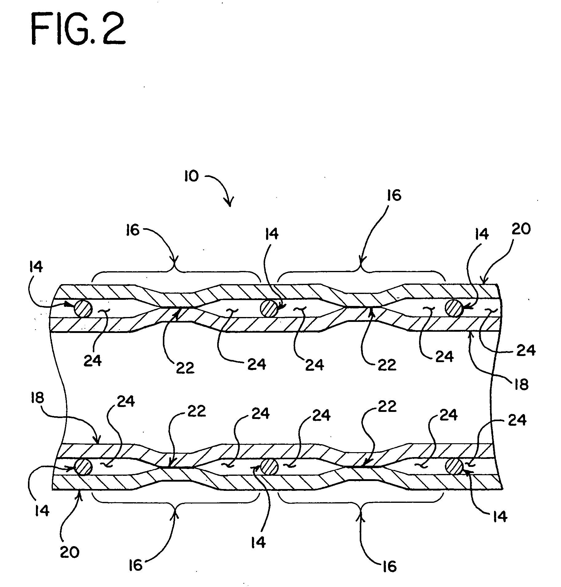 Stent-graft with graft to graft attachment