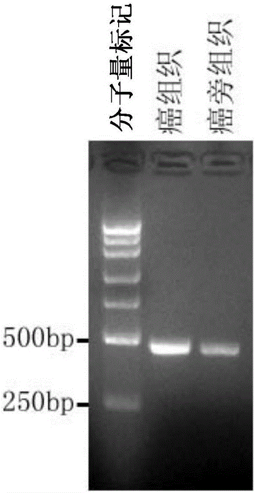 Method for detecting circular RNA for bladder cancer screening and application thereof