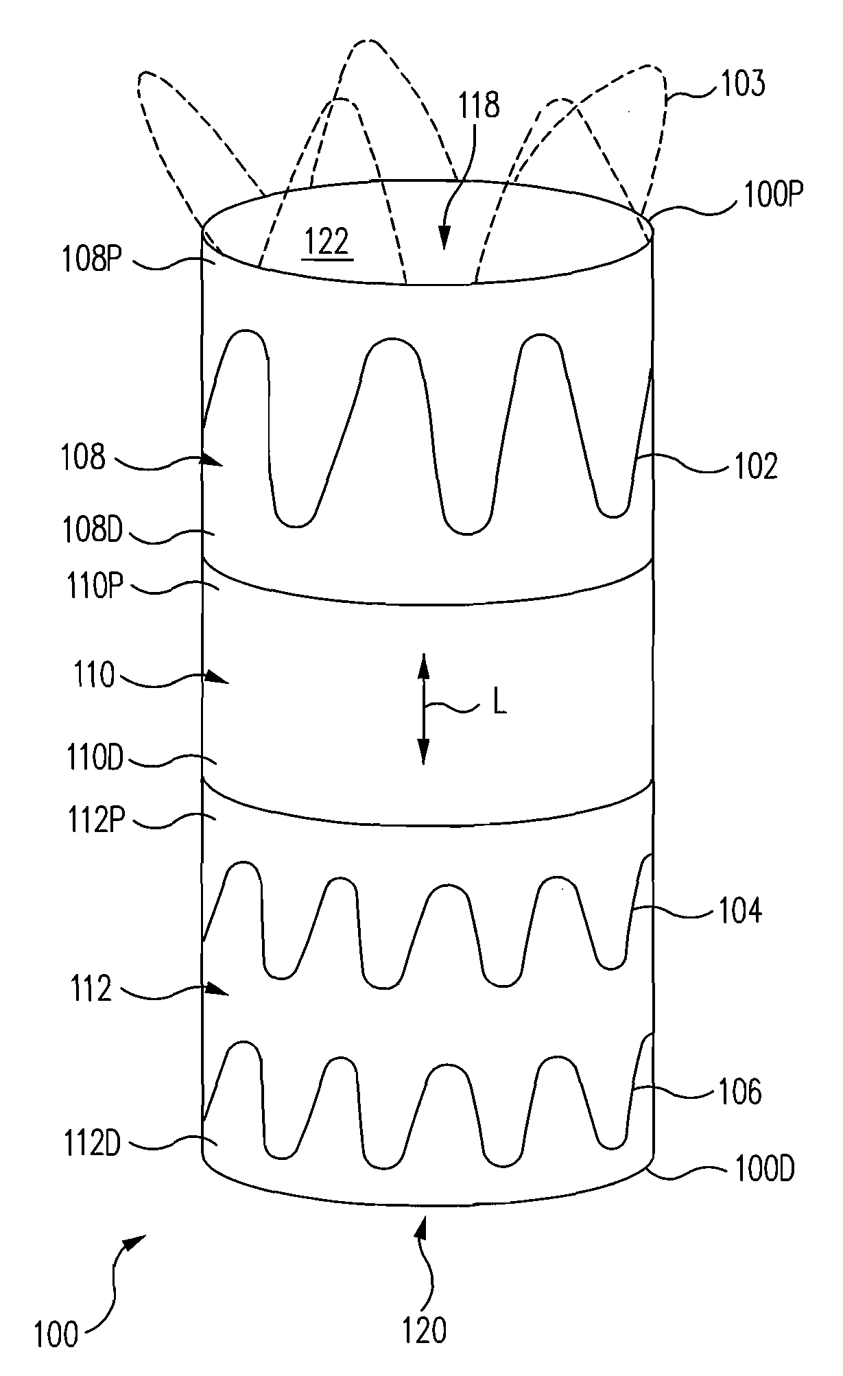 Fenestration Segment Stent-Graft and Fenestration Method