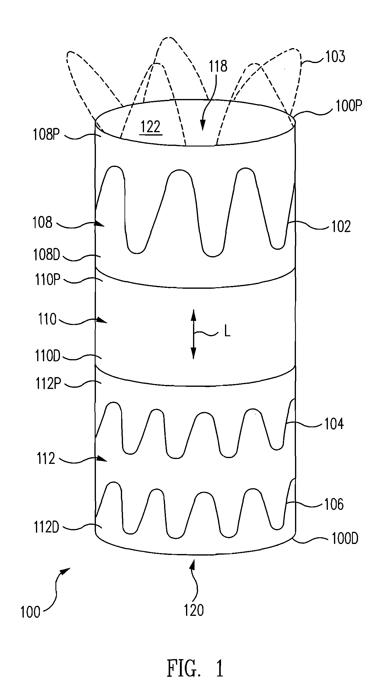 Fenestration Segment Stent-Graft and Fenestration Method