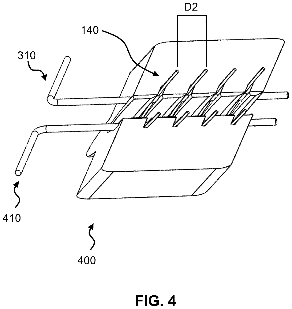 Medical Device for Anastomosis