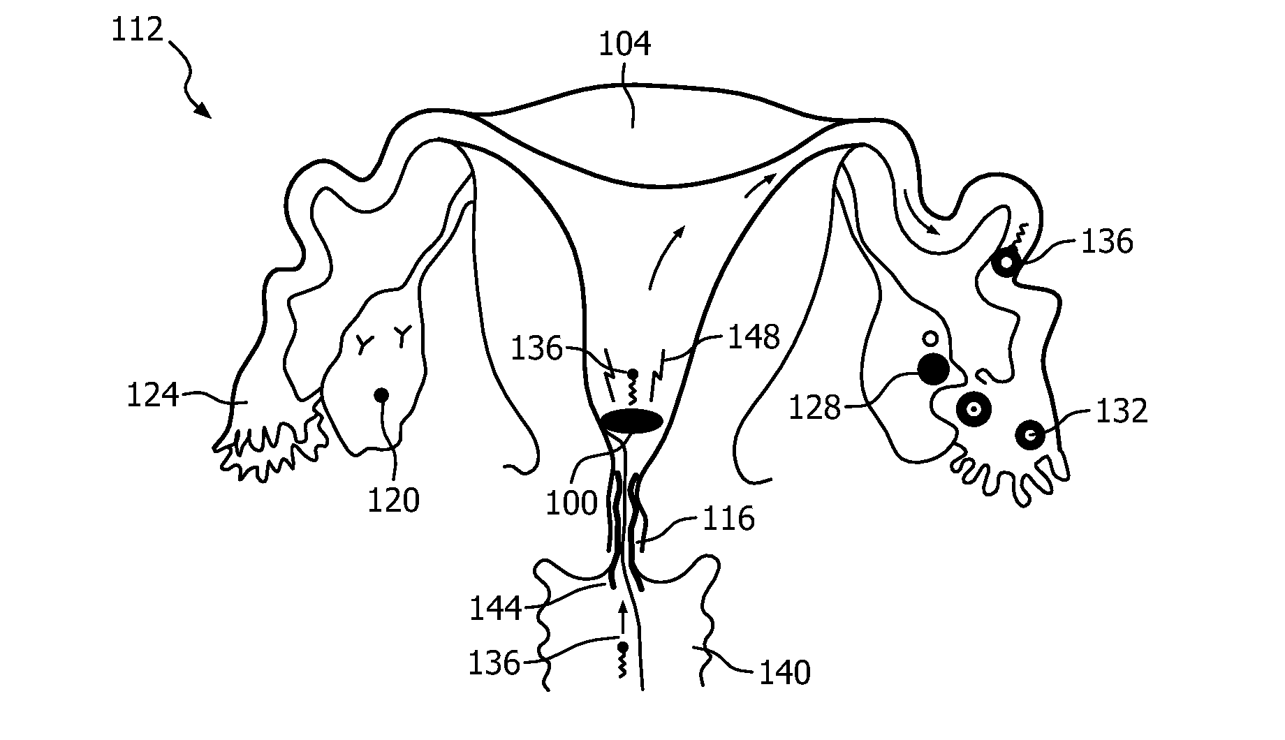 Intrauterine electronic capsule for administering a substance