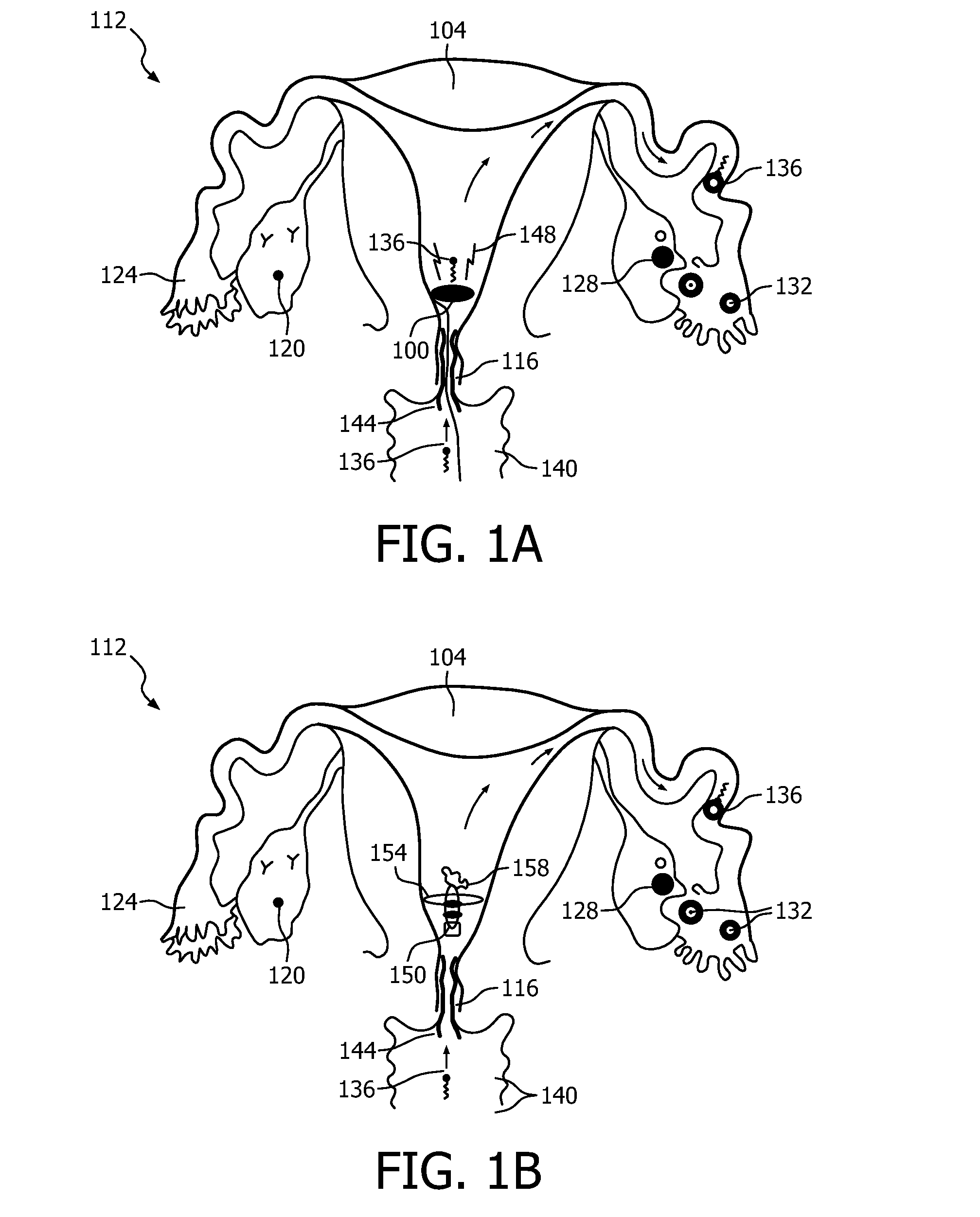 Intrauterine electronic capsule for administering a substance