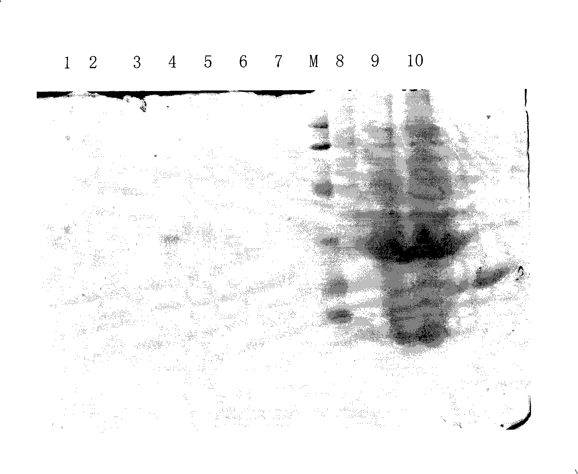 Tuberculosis antigen specific whole blood IFN-gamma diagnosis kit, method for producing the same and method for using same