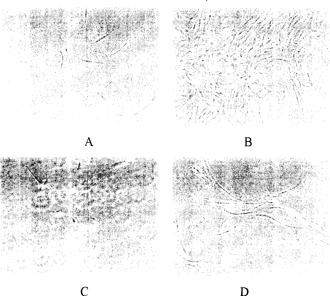 Method for sorting human marrow mesenchymal stem cell by monoclonal antibody ZUE12 immunomagnetic bead