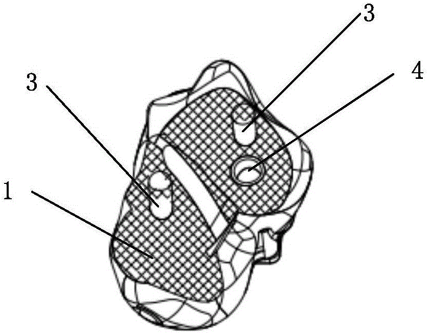 Talus prosthesis