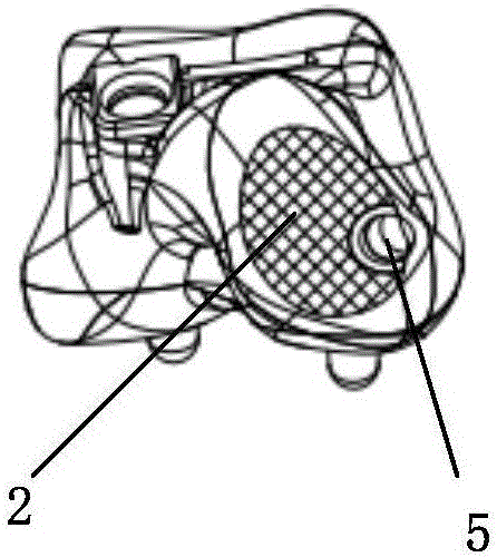 Talus prosthesis