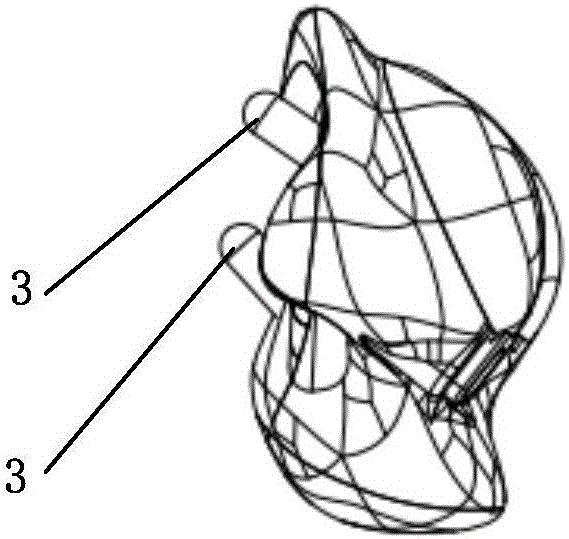 Talus prosthesis