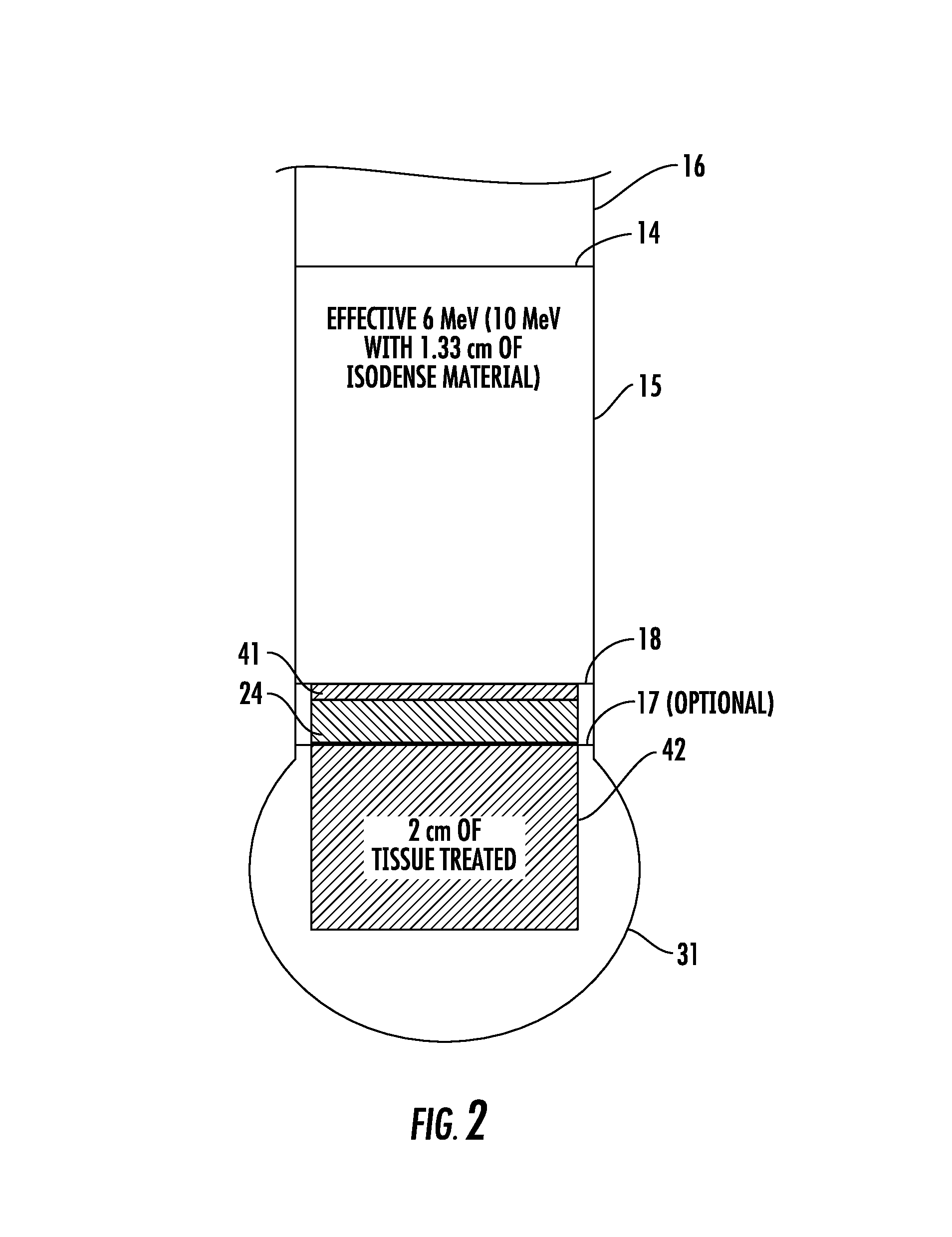 Method of mechanically controlling the amount of energy to reach a patient undergoing intraoperative electron radiation therapy