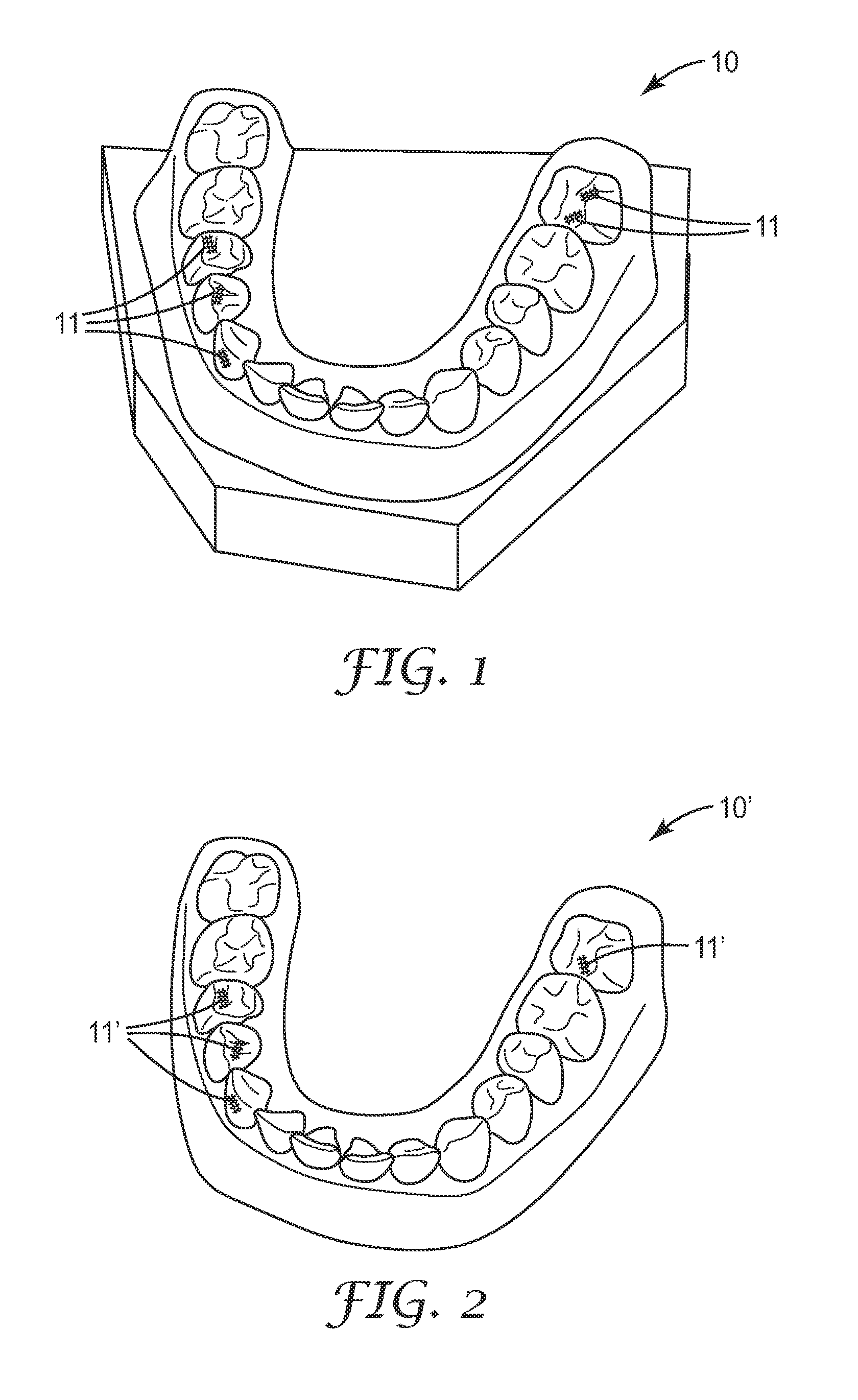 Method in the making of a dental restoration