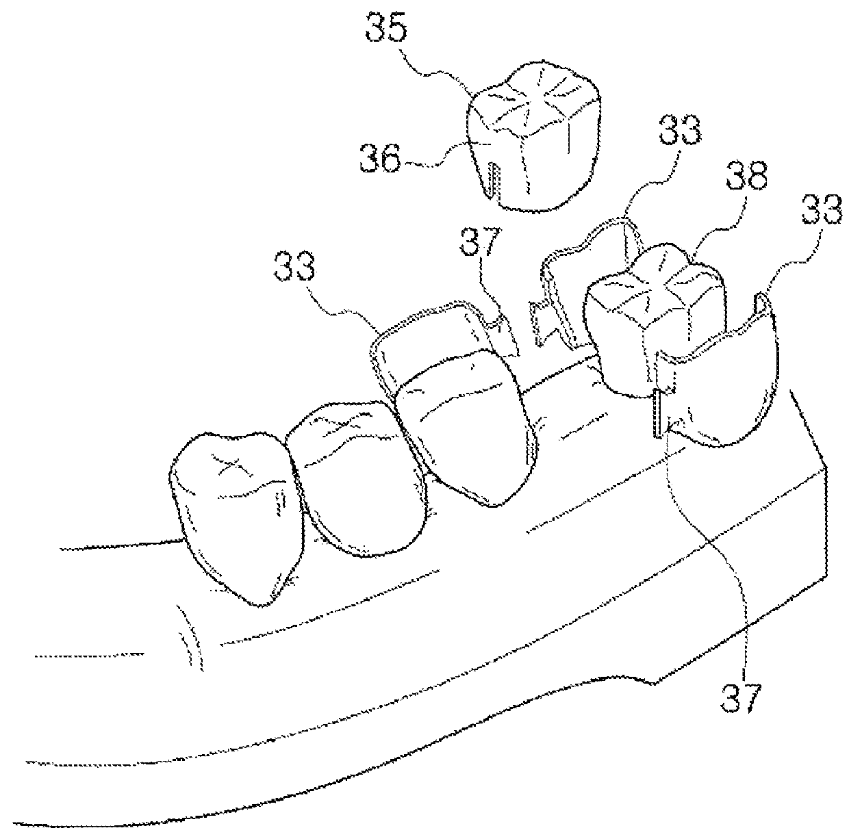 Dental prosthesis and manufacturing method thereof