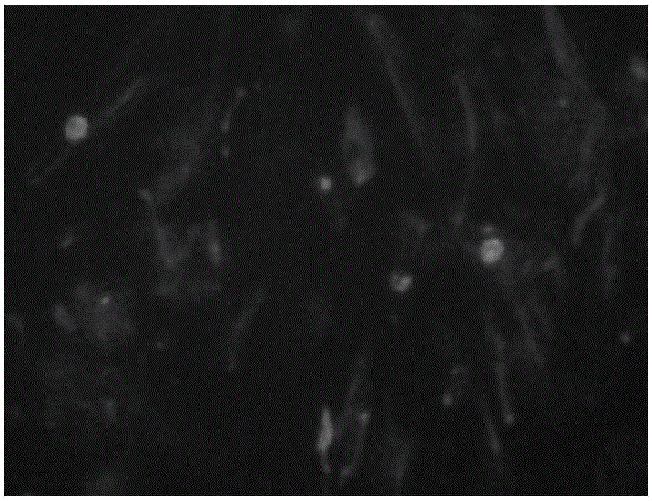 New application of beta-N-acetylglucosaminyl transferase